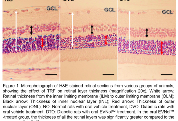 EVNol-increases-retinal-thickness-diabetic-retinopathy