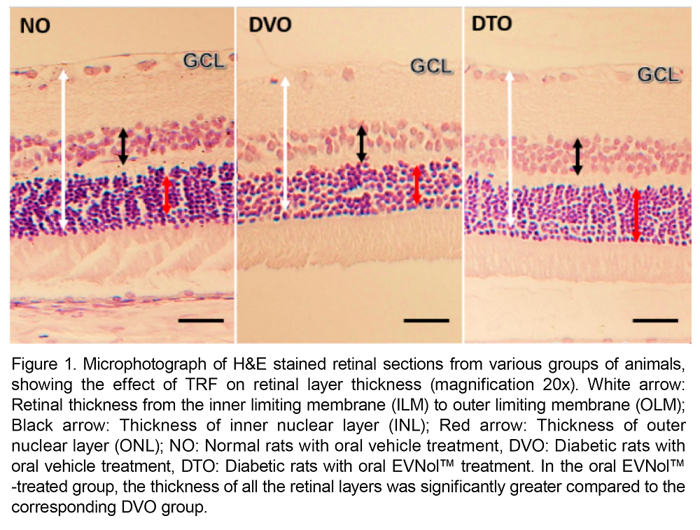 EVNol-increases-retinal-thickness-diabetic-retinopathy